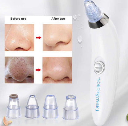 Head Remover Machine - Acne Pore Cleaner Vacuum Suction Tool Blackhead Removal